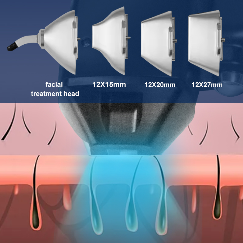 https://www.hongqilaser.com/es/producto/808-diode-laser-2/feed/