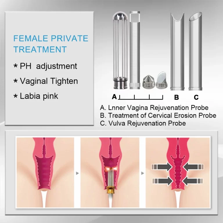 Female Private Treatment Probes for Thulium Fiber Laser System