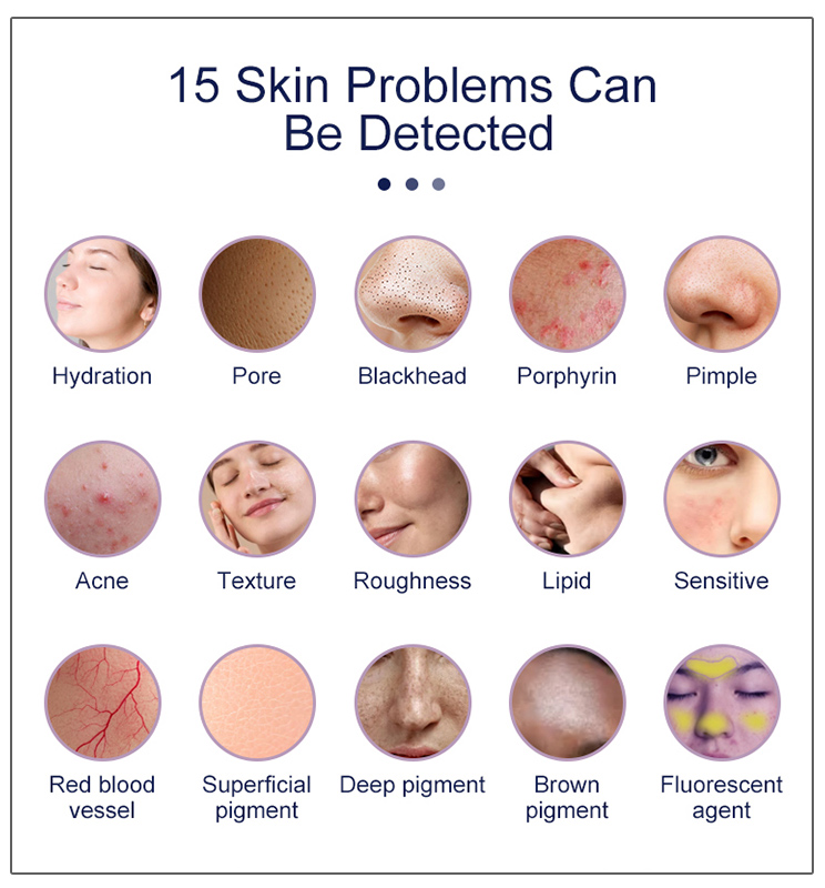 Skin analyzer showing 15 indicators including hydration, pores, acne, pigmentation, and sensitivity