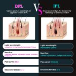 DPL vs IPL Technology