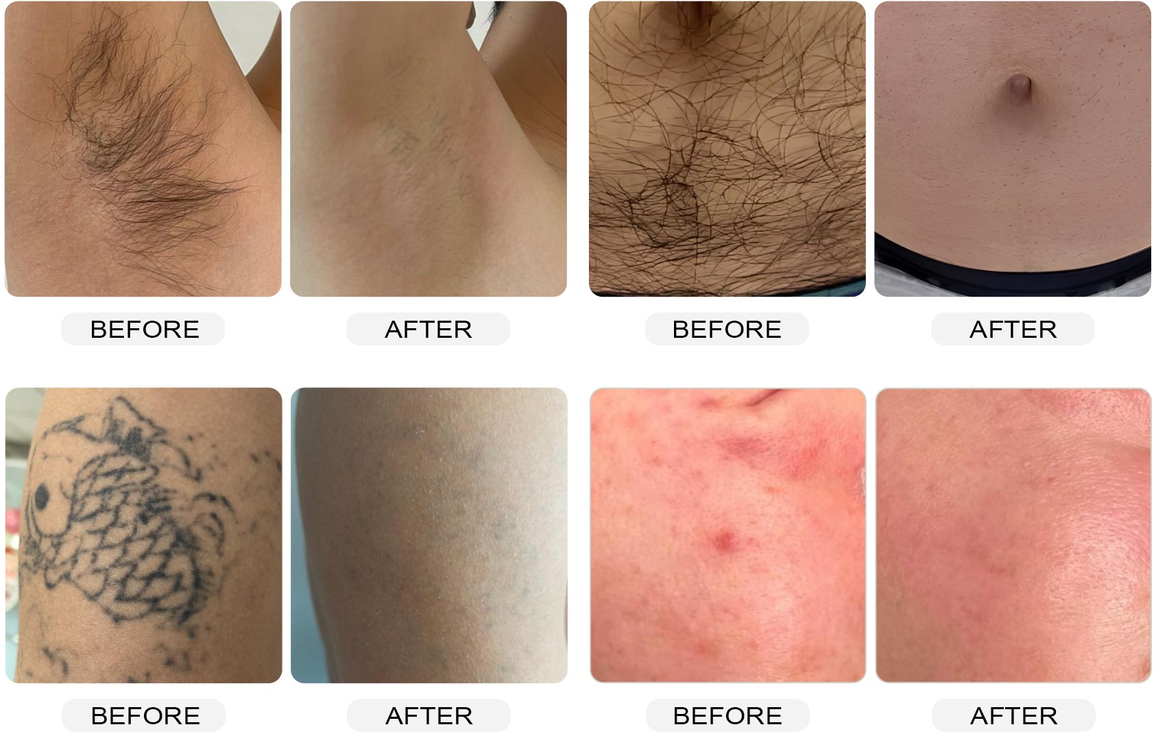 Before-and-after treatment comparison for hair, tattoo, and skin appearance