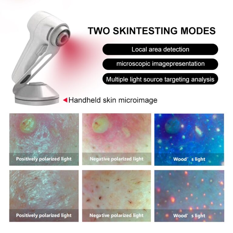Handheld Skin Micro-Imaging Probe