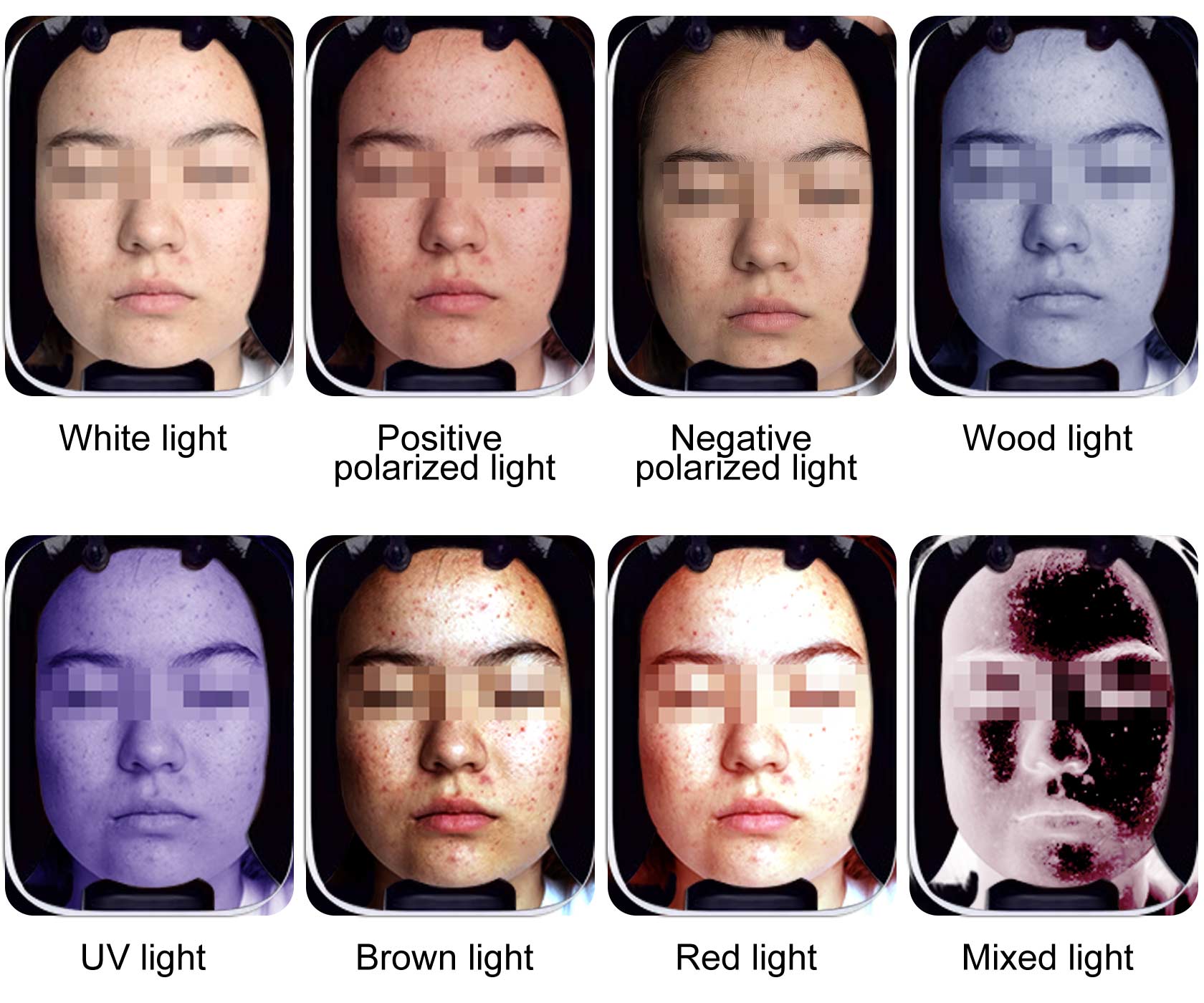 Eight-spectrum facial skin images under white, polarized, Wood, UV, brown, red, and mixed light