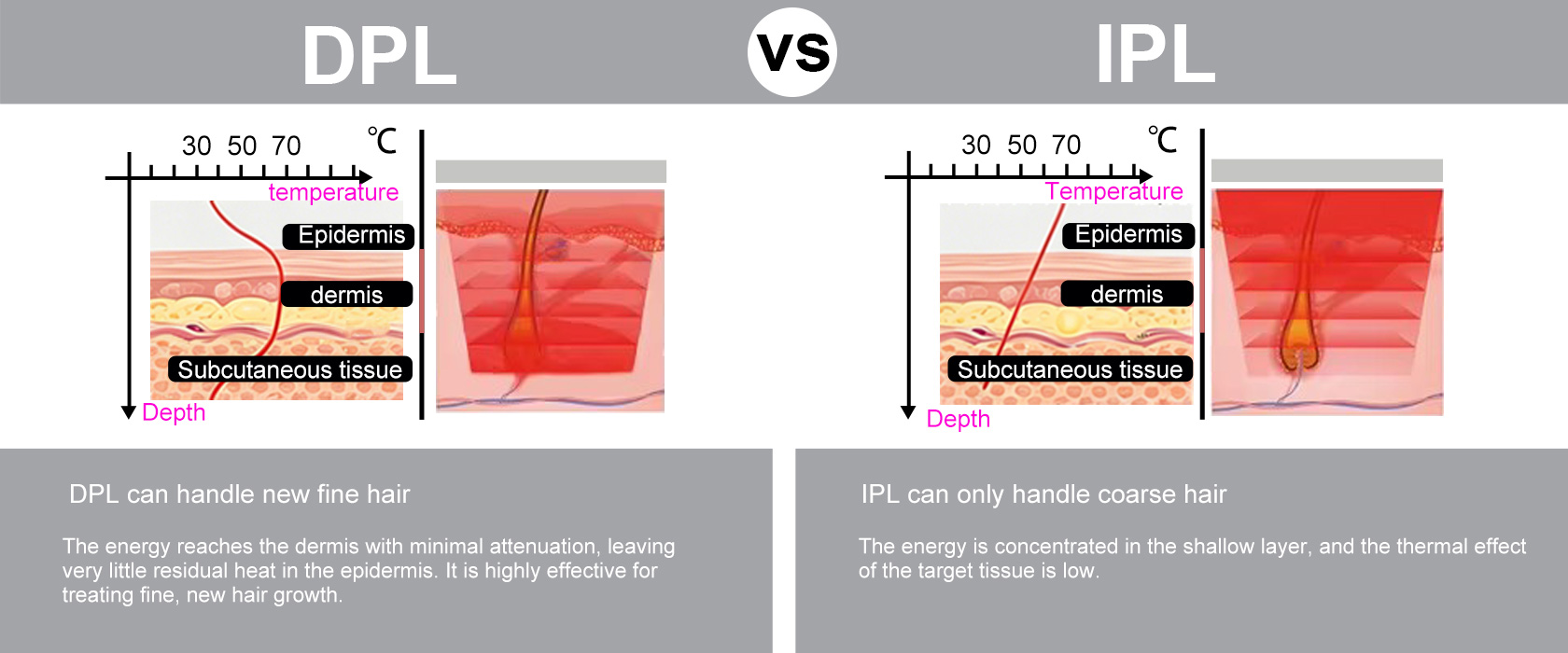Comparison of DPL and IPL energy depth for hair treatment